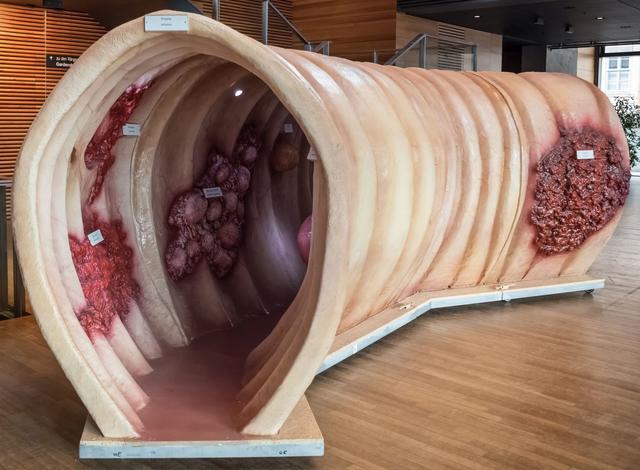 Mit einem begehbaren Darmmodell ist das St. Elisabeth-Krankenhaus auf der Messe „La Vita“ in Pirmasens vertreten. Foto: ps