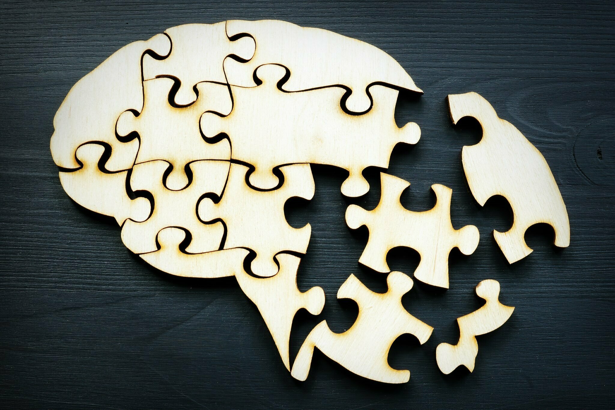 Alterung & Demenzangst? Dieser Einfache Trick (Lebensstilintervention) Kann Helfen! - r1bkpra