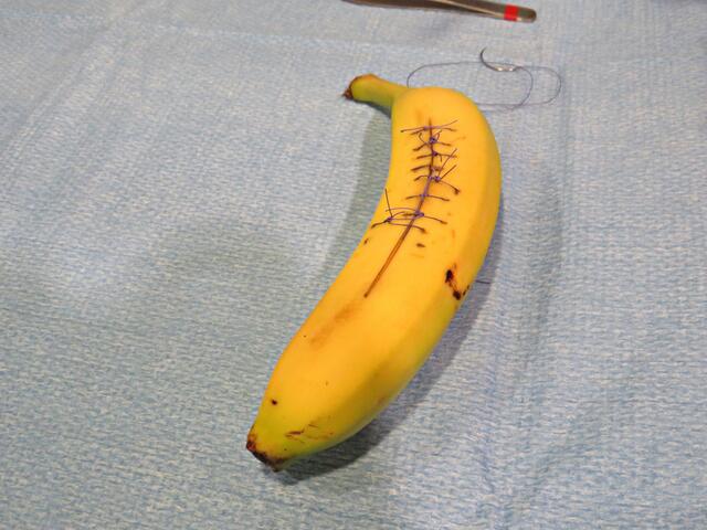 Patient = Banane | Foto: Brigitte Melder
