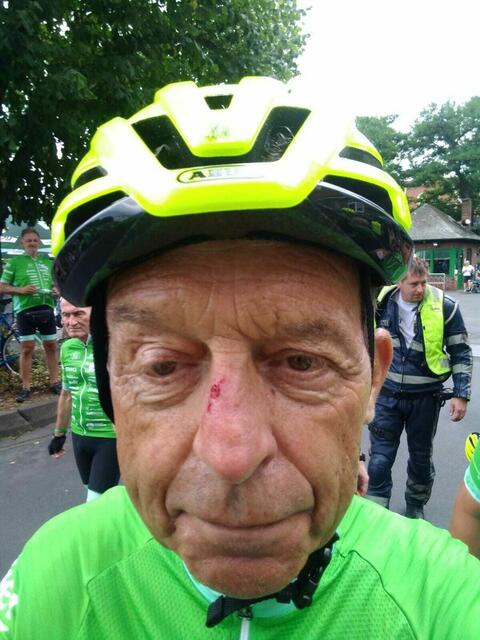 Rudi Birkmeyer nach dem Sturz bei der TOUR der Hoffnung | Foto: Rudi Birkmeyer