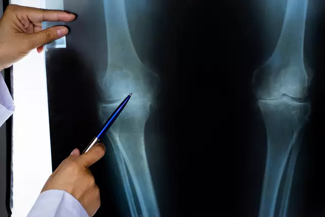 Chirurgische Eingriffe und Medikamente: Was ist sinnvoll? / Symbolbild | Foto: lesterman/stock.adobe.com