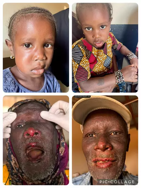 Vor und eine Woche nach der Behandlung | Foto: Andrea Sprengart