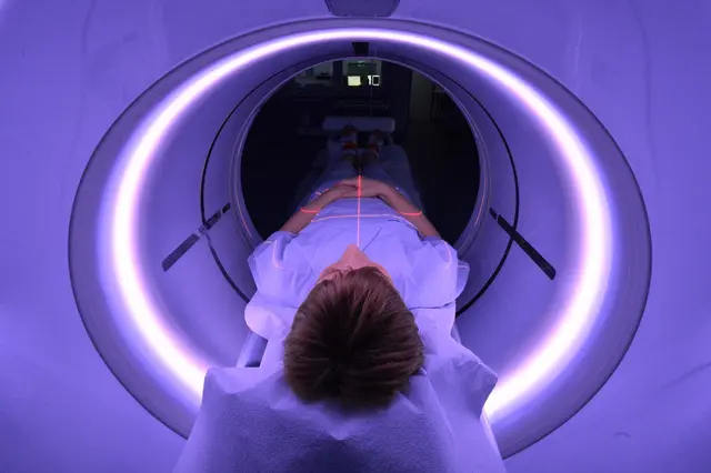 Moderne Diagnostik im Einsatz: Das Screening erfolgt per Niedrigdosis-CT, das Tumoren bereits im Frühstadium sichtbar macht. (zu dpa: «Lungenkrebsscreening für Raucher: Ist das etwas für mich?») | Foto: dpa