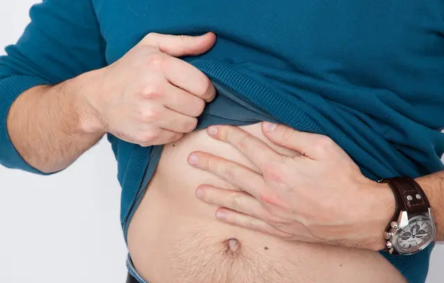 Besonders betroffen von Bauchnabelflusen sind Männer.  | Foto: dpa