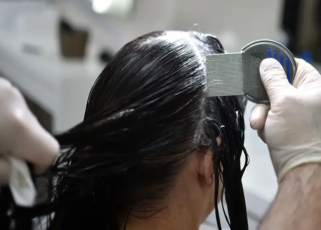 Gründliche Untersuchung ist entscheidend: Mit einem Läusekamm und einer Haarspülung lassen sich Läuse und Eier im feuchten Haar am zuverlässigsten aufspüren. | Foto: dpa