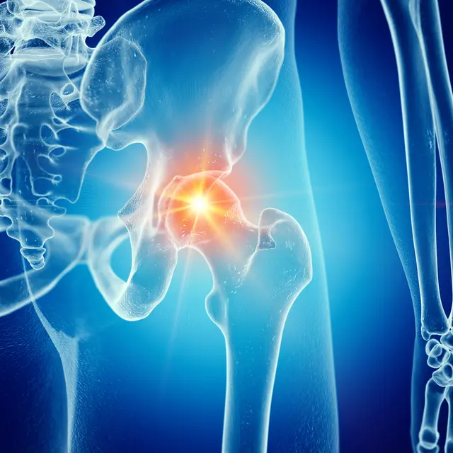 Patientenforum Orthopädie und Unfallchirurgie in Uni-Klinik Mannheim / Symbolbild | Foto: SciePro/stock.adobe.com