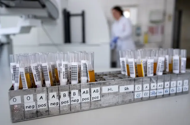 Blut ist nicht gleich Blut: Entscheidend für die Einsortierung in eine Blutgruppe ist, welche Antigene sich auf der Hülle der roten Blutkörperchen befinden. | Foto: dpa