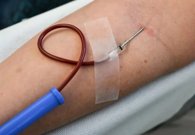 Es wird derzeit wenig Blut gespendet - mit Folgen. (Symbolbild) | Foto: Jens Kalaene/dpa