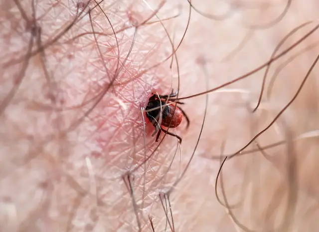 Zecken sitzen häufig im hohen Gras. Da sie Krankheiten übertragen können, sollte man die Einstichstelle gut beobachten, um Anzeichen von Krankheiten wie Borreliose schnell erkennen zu können.  | Foto: Volodymyr Shevchuk/stock.adobe.com